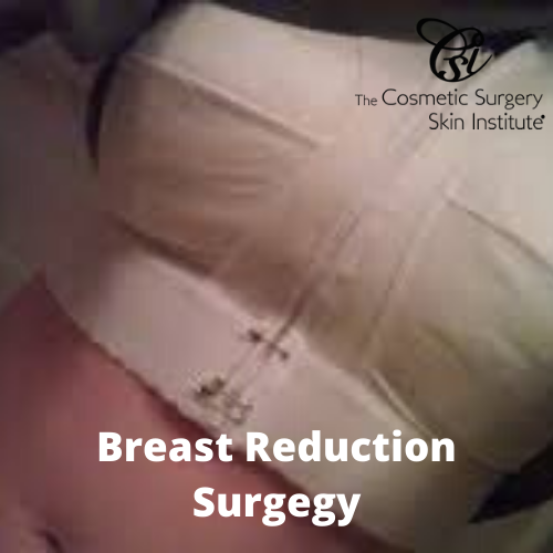 Breast Reduction Surgery