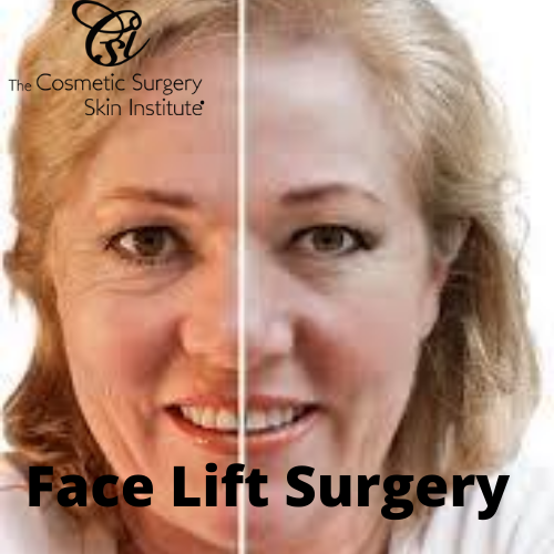 Face Lift Surgery Use