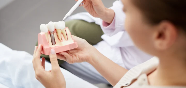 Dental Implants Clinic – Impressionz Dental Care