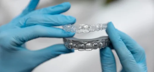 Invisalign Treatment - Impressionz Dental Care